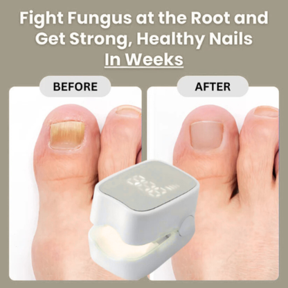 HalaHub™ - Nail Fungus Laser Device