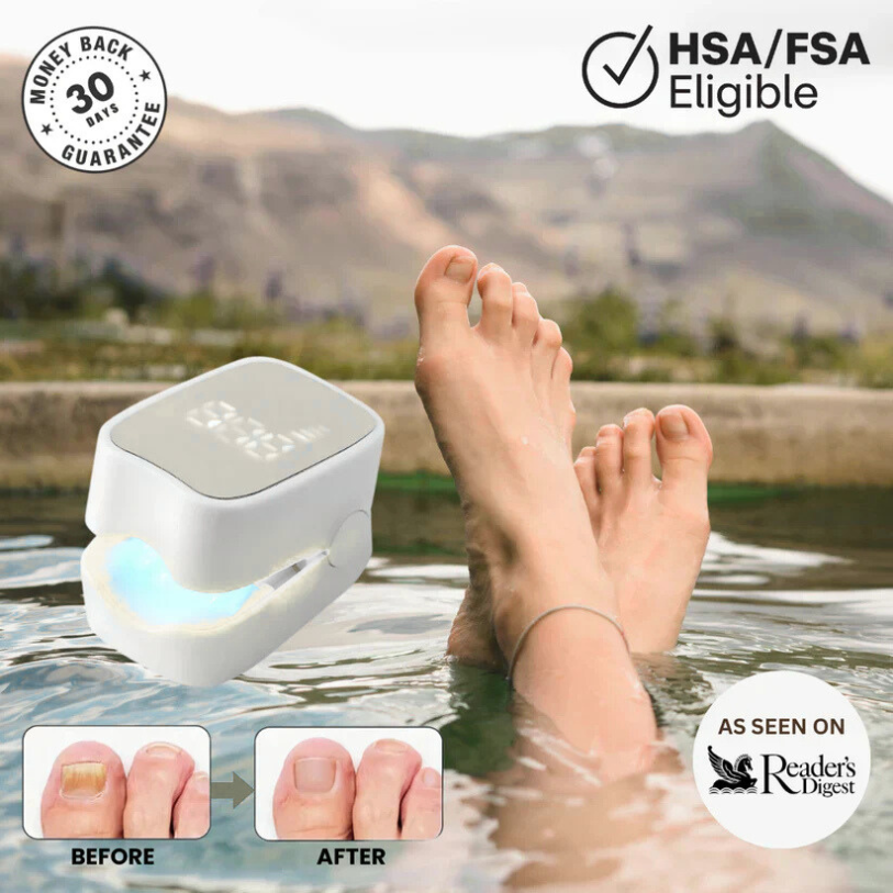 HalaHub™ - Nail Fungus Laser Device